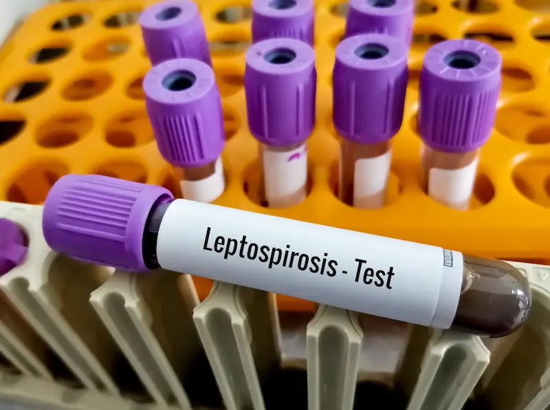 What Leads To Signs Of Leptospirosis